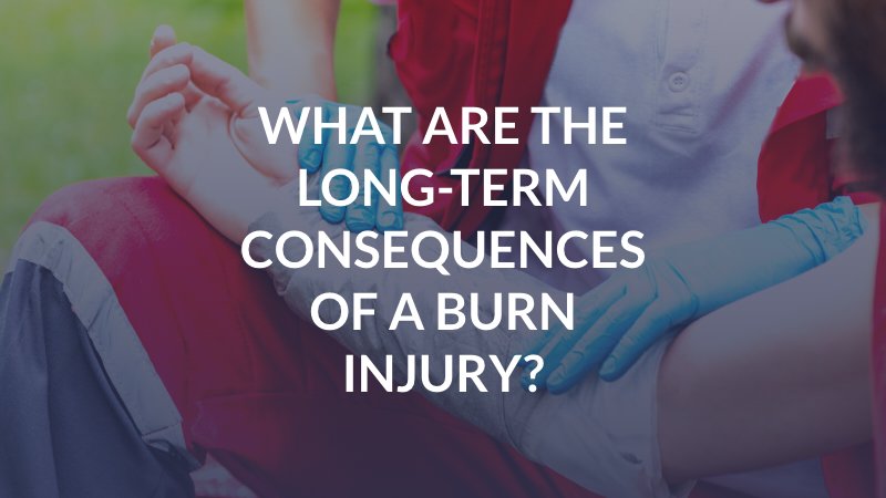 Jackson, Mississippi Burn Injury Attorney