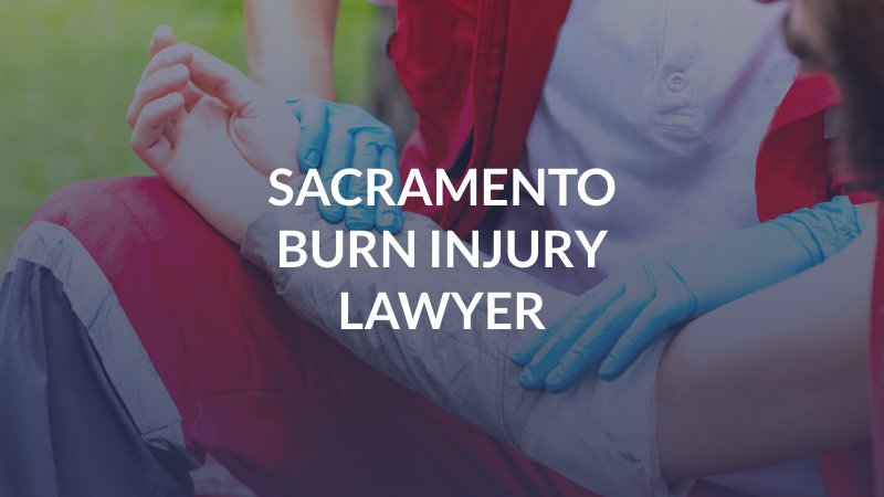 Sacramento Burn Injury Lawyer